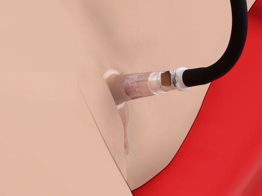 Clitoris Pumping System - UABDSM