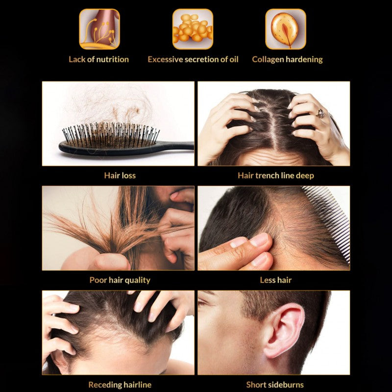 Spray For Hair Growth Against Hair Loss Omy Lady Hair Growth Spray 60ml - UABDSM
