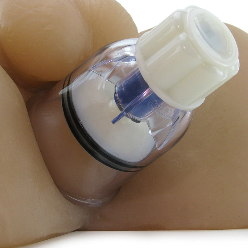 Intake Anal Suction Device - UABDSM